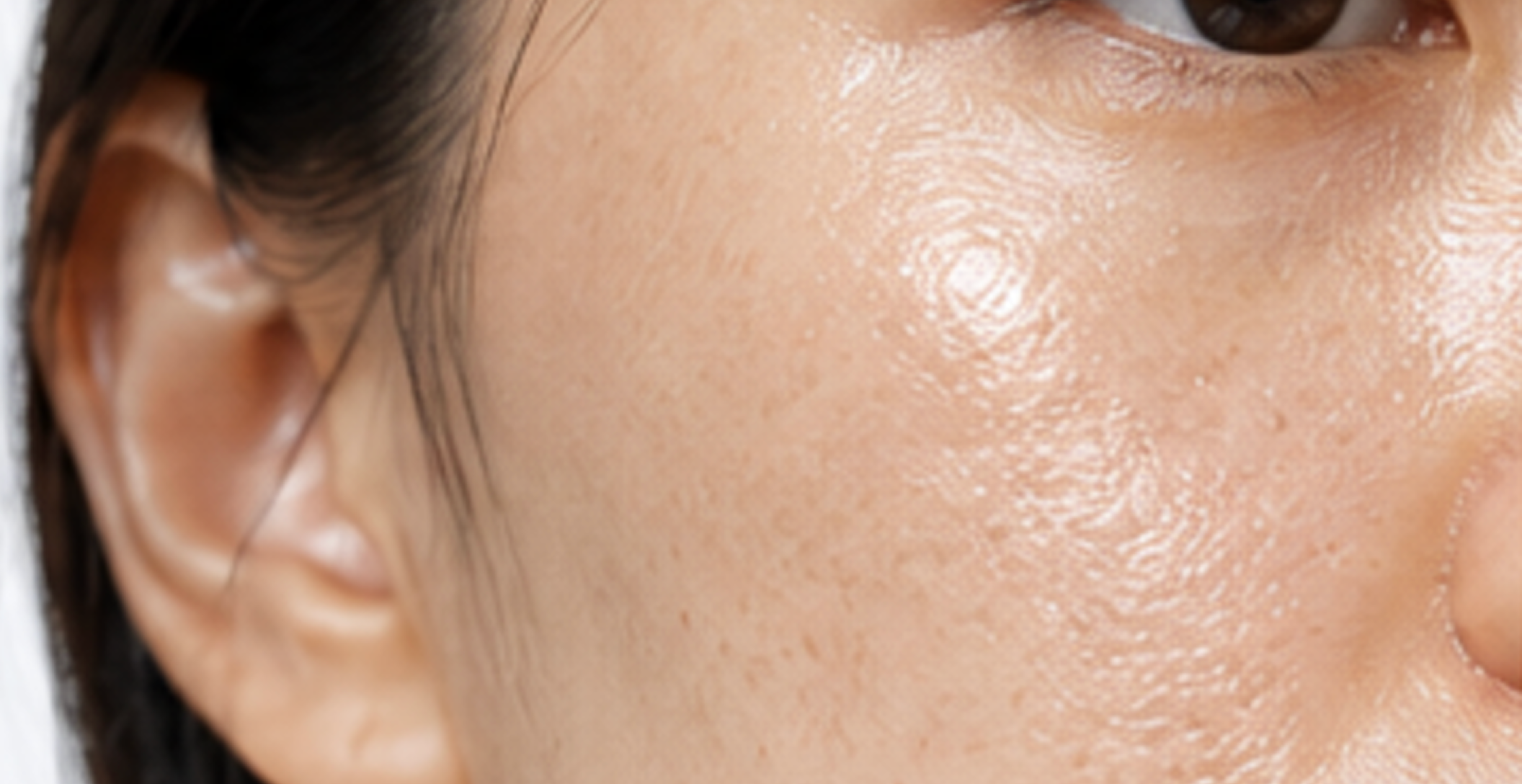 <p>Oily T-zone, dry cheeks, and nothing feels right.</p>